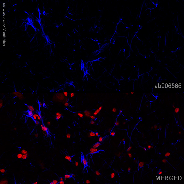 Immunohistochemistry (Frozen sections) - Alexa Fluor® 405 Anti-GFAP antibody [EPR1034Y] (AB206586), expandable thumbnail