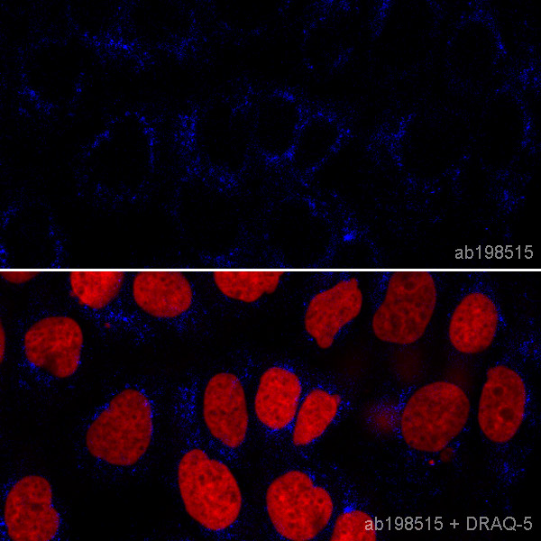 Immunocytochemistry/ Immunofluorescence - Alexa Fluor® 405 Anti-M6PR (cation independent) antibody [EPR6599] - Lysosome Membrane Marker (AB198515)