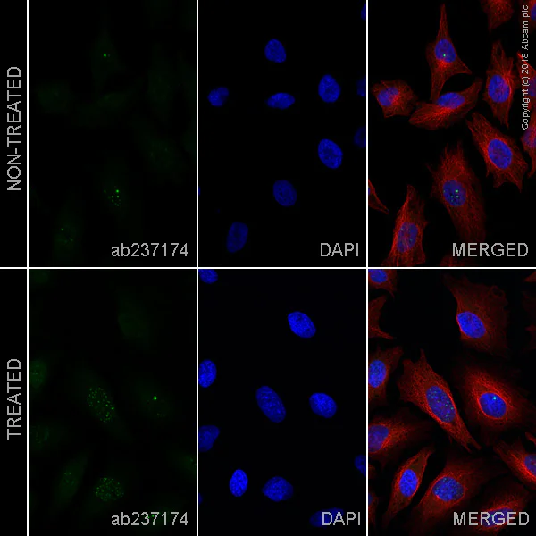 Immunocytochemistry/ Immunofluorescence - Alexa Fluor® 488 Anti-53BP1 antibody [EPR2172(2)] (AB237174)