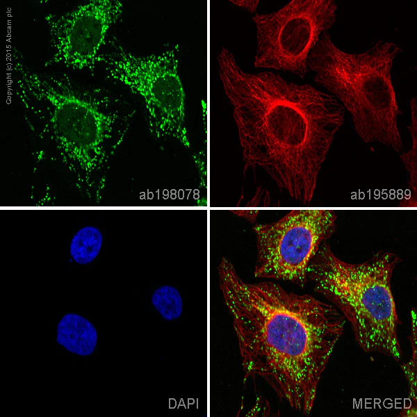 Immunocytochemistry/ Immunofluorescence - Alexa Fluor® 488 Anti-ACADM/MCAD antibody [3B7BH7] (AB198078)