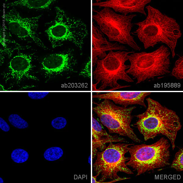 Immunocytochemistry/ Immunofluorescence - Alexa Fluor® 488 Anti-ACADM/MCAD antibody [EPR3708] (AB203262)