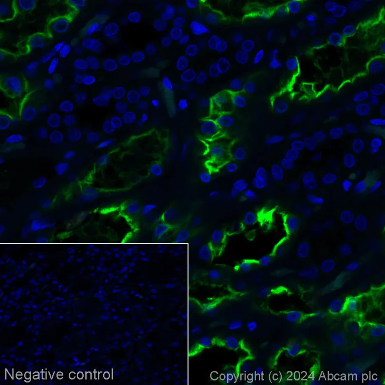 Immunohistochemistry (Formalin/PFA-fixed paraffin-embedded sections) - Alexa Fluor® 488 Anti-ACE2 antibody [EPR4435(2)] (AB317075)