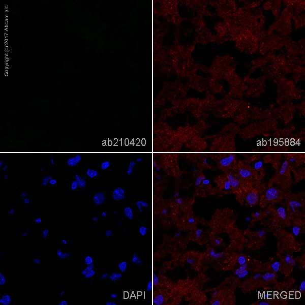 Immunohistochemistry (Frozen sections) - Alexa Fluor® 488 Anti-ACTN3 antibody [EP2531Y] - Cytoskeleton Marker (AB210420)