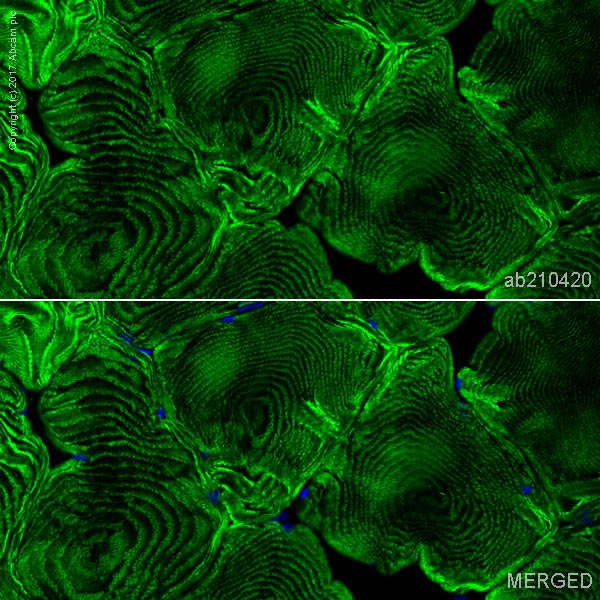 Immunohistochemistry (Frozen sections) - Alexa Fluor® 488 Anti-ACTN3 antibody [EP2531Y] (AB210420), expandable thumbnail