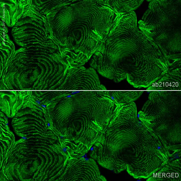 Immunohistochemistry (Frozen sections) - Alexa Fluor® 488 Anti-ACTN3 antibody [EP2531Y] - Cytoskeleton Marker (AB210420)