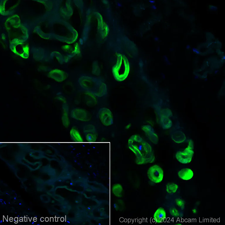 Immunohistochemistry (Formalin/PFA-fixed paraffin-embedded sections) - Alexa Fluor® 488 Anti-Aggrecan [6-B-4] (AB318312)