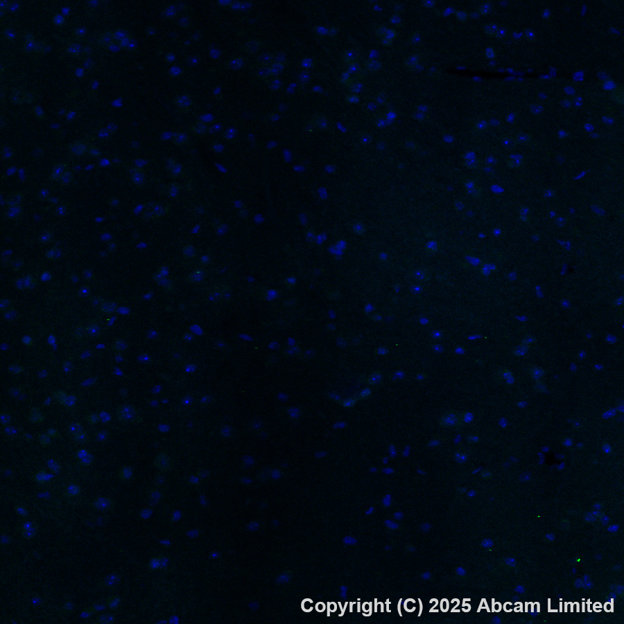 Immunohistochemistry (Formalin/PFA-fixed paraffin-embedded sections) - Alexa Fluor® 488 Anti-AIRE antibody [EPR28045-139] (AB323447), expandable thumbnail