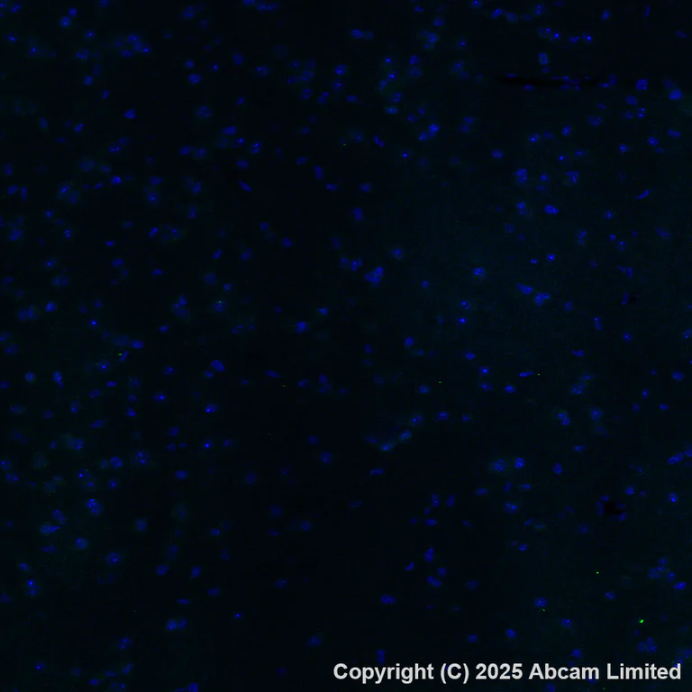 Immunohistochemistry (Formalin/PFA-fixed paraffin-embedded sections) - Alexa Fluor® 488 Anti-AIRE antibody [EPR28045-139] (AB323447)