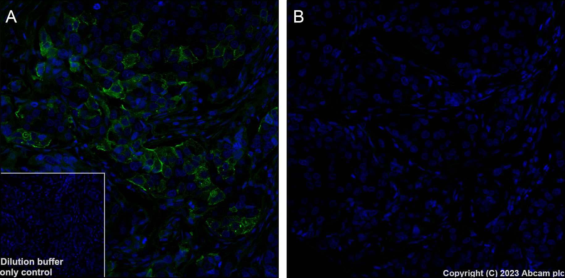 Immunohistochemistry (Formalin/PFA-fixed paraffin-embedded sections) - Alexa Fluor® 488 Anti-AKT1 (phospho S473) antibody [EP2109Y] (AB313593)