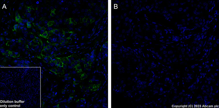 Immunohistochemistry (Formalin/PFA-fixed paraffin-embedded sections) - Alexa Fluor® 488 Anti-AKT1 (phospho S473) antibody [EP2109Y] (AB313593)