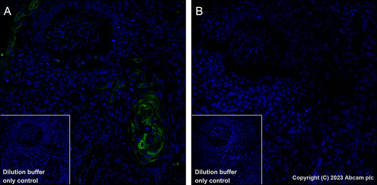 Immunohistochemistry (Formalin/PFA-fixed paraffin-embedded sections) - Alexa Fluor® 488 Anti-AKT1 (phospho S473) antibody [EP2109Y] (AB313593)