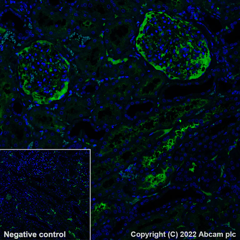 Immunohistochemistry - Alexa Fluor® 488 Anti-Albumin antibody [EPR12774] (AB302577)