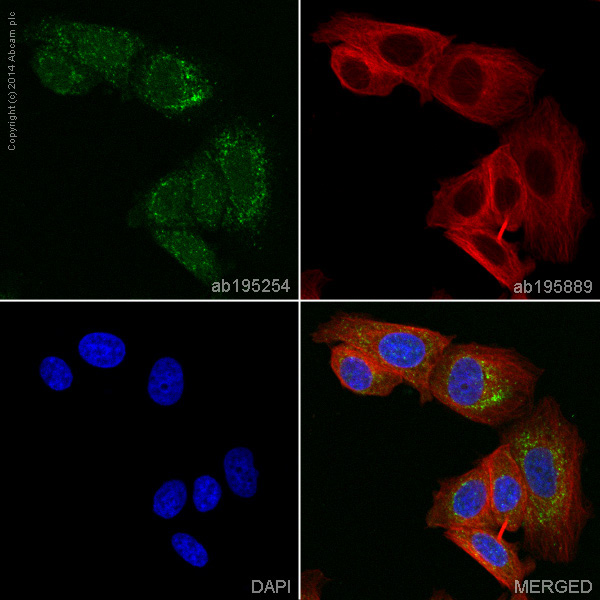 Immunocytochemistry/ Immunofluorescence - Alexa Fluor® 488 Anti-ALDH1A1 antibody [EP1933Y] (AB195254), expandable thumbnail