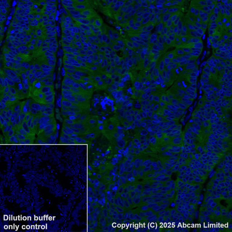 Immunohistochemistry (Formalin/PFA-fixed paraffin-embedded sections) - Alexa Fluor® 488 Anti-ALDH1A1 antibody [EP1933Y] (AB195254)