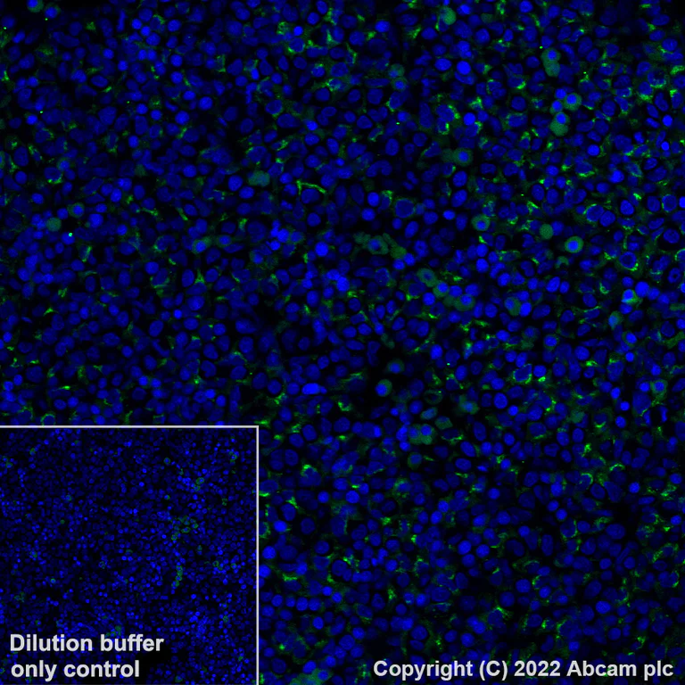 Immunohistochemistry (Formalin/PFA-fixed paraffin-embedded sections) - Alexa Fluor® 488 Anti-alpha 1 Fetoprotein antibody [EPR26548-19] (AB307861)
