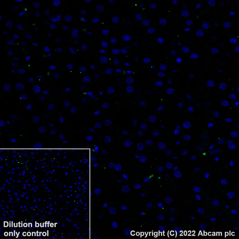 Immunohistochemistry (Formalin/PFA-fixed paraffin-embedded sections) - Alexa Fluor® 488 Anti-alpha 1 Fetoprotein antibody [EPR26548-19] (AB307861)