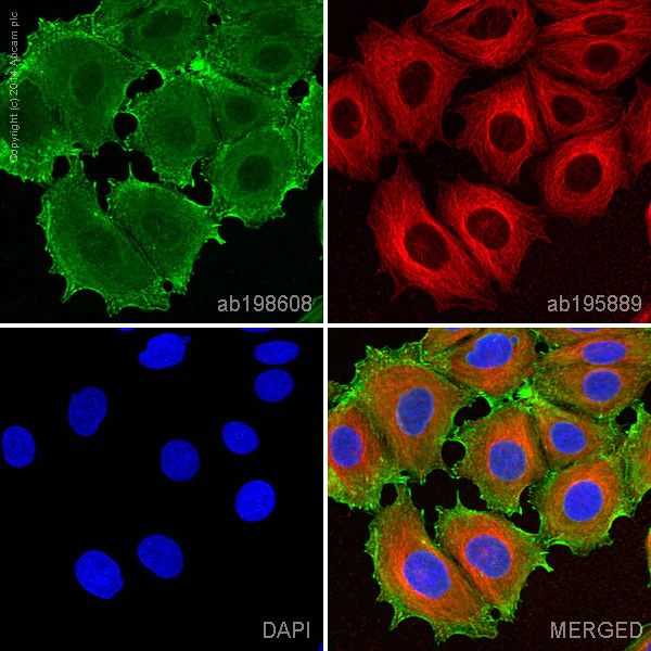Immunocytochemistry/ Immunofluorescence - Alexa Fluor® 488 Anti-alpha Actinin 4 antibody [EPR2533(2)] - Cytoskeleton Marker (AB198608)