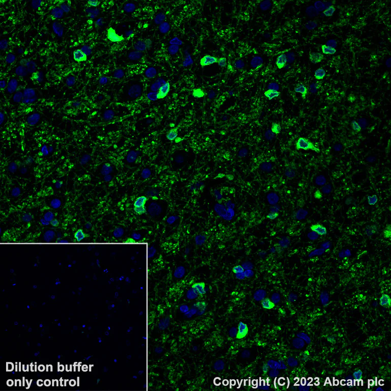 Immunohistochemistry (Formalin/PFA-fixed paraffin-embedded sections) - Alexa Fluor® 488 Anti-Alpha B Crystallin antibody [EPR2752] (AB315853)