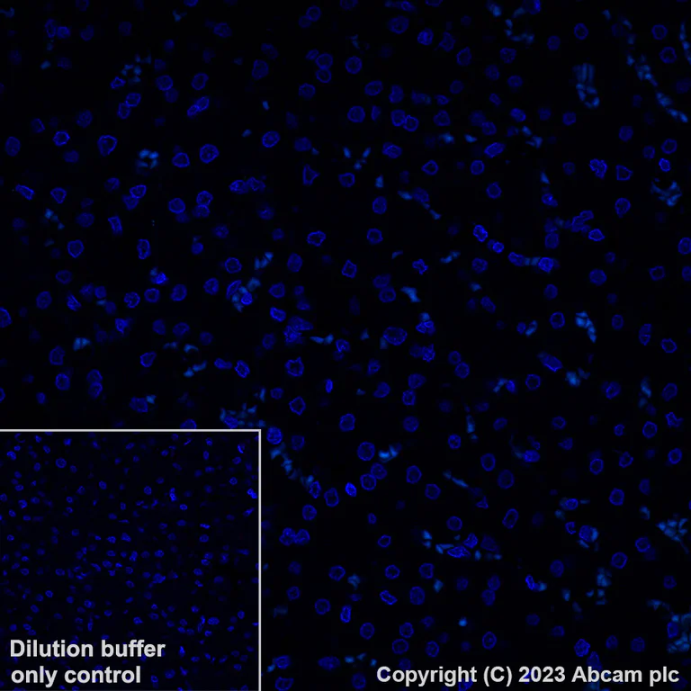 Immunohistochemistry (Formalin/PFA-fixed paraffin-embedded sections) - Alexa Fluor® 488 Anti-Alpha B Crystallin antibody [EPR2752] (AB315853)