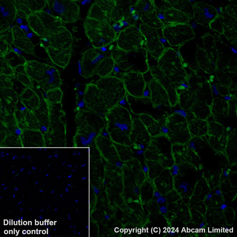 Immunohistochemistry (Formalin/PFA-fixed paraffin-embedded sections) - Alexa Fluor® 488 Anti-alpha Sarcoglycan antibody [EPR14773] (AB321851)