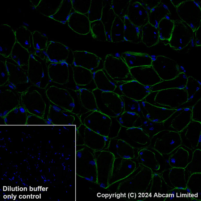 Immunohistochemistry (Formalin/PFA-fixed paraffin-embedded sections) - Alexa Fluor® 488 Anti-alpha Sarcoglycan antibody [EPR14773] (AB321851)