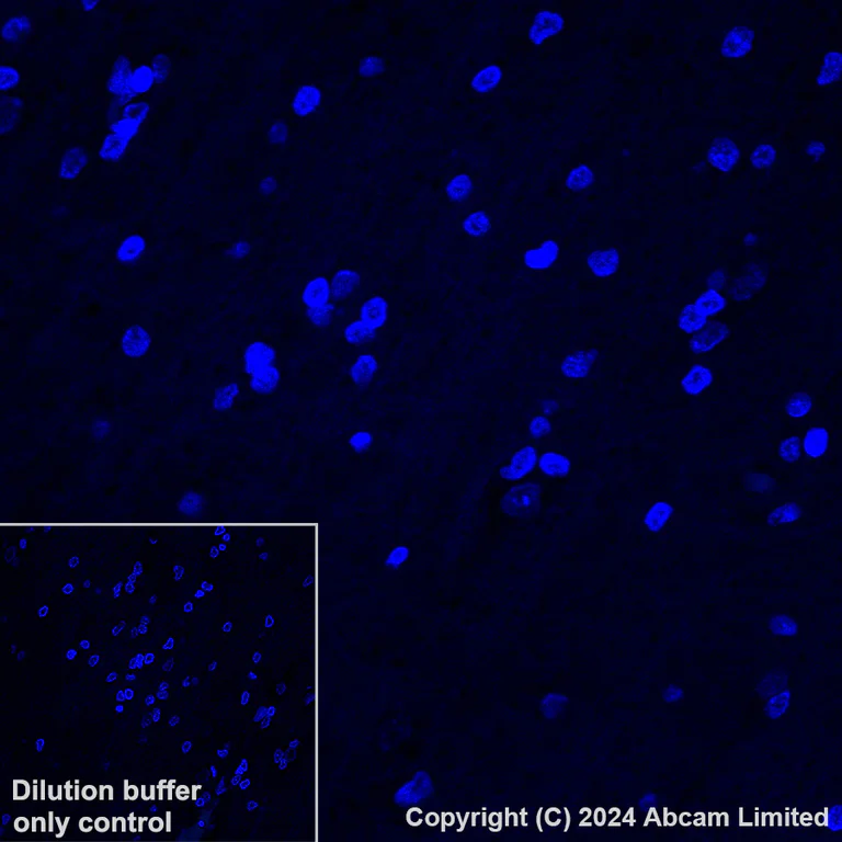 Immunohistochemistry (Formalin/PFA-fixed paraffin-embedded sections) - Alexa Fluor® 488 Anti-alpha Sarcoglycan antibody [EPR14773] (AB321851)