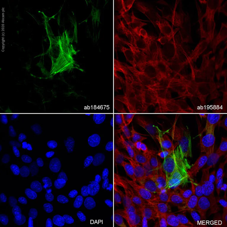 【Macさま専用】Platycerium 'Elsa' とF304 Anti-alpha smooth muscle Actin Alexa Fluor® 488 antibody