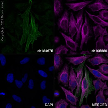 Anti-alpha smooth muscle Actin Alexa Fluor® 488 antibody [1A4