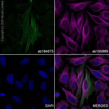 Anti-alpha smooth muscle Actin Alexa Fluor® 488 antibody [1A4