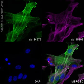 Immunocytochemistry/ Immunofluorescence - Alexa Fluor® 488 Anti-alpha smooth muscle Actin antibody [1A4] (AB184675)