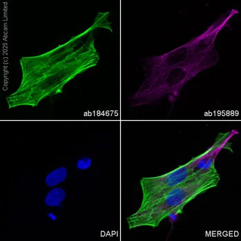 Immunocytochemistry/ Immunofluorescence - Alexa Fluor® 488 Anti-alpha smooth muscle Actin antibody [1A4] (AB184675)