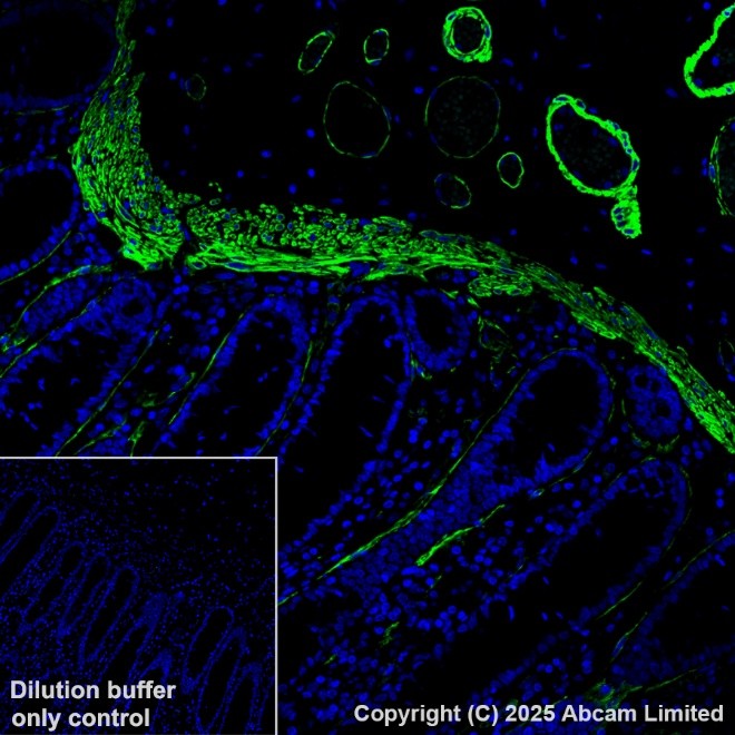 Anti-alpha smooth muscle Actin Alexa Fluor® 488 antibody [1A4