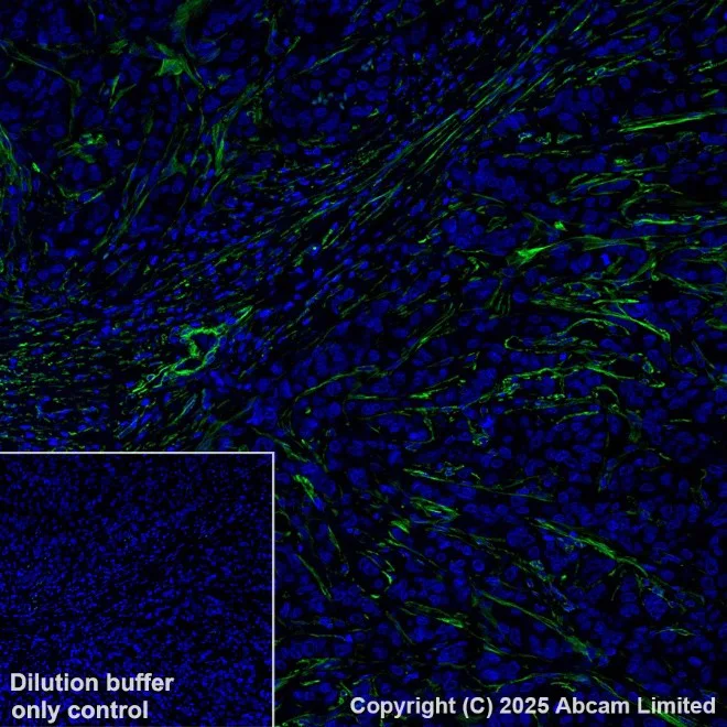 Anti-alpha smooth muscle Actin Alexa Fluor® 488 antibody [1A4