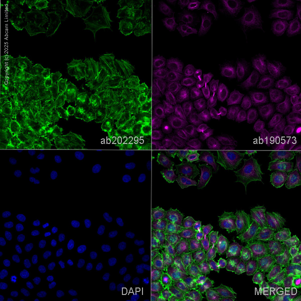 Immunocytochemistry - Alexa Fluor® 488 Anti-alpha smooth muscle Actin antibody [EPR5368] (AB202295), expandable thumbnail