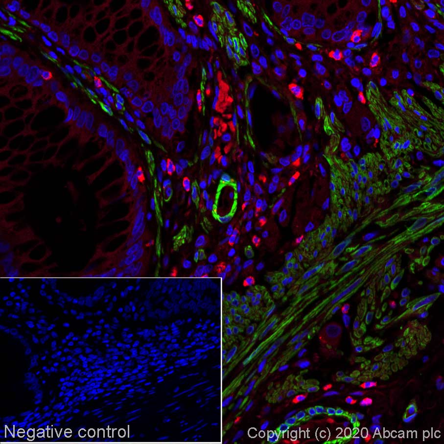 Immunohistochemistry (Formalin/PFA-fixed paraffin-embedded sections) - Alexa Fluor® 488 Anti-alpha smooth muscle Actin antibody [SP171] (AB267536), expandable thumbnail