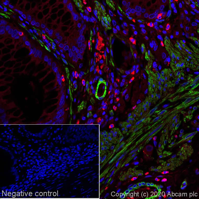 Immunohistochemistry (Formalin/PFA-fixed paraffin-embedded sections) - Alexa Fluor® 488 Anti-alpha smooth muscle Actin antibody [SP171] (AB267536)