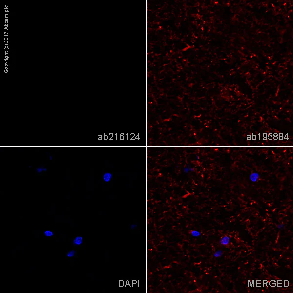 Immunohistochemistry (Frozen sections) - Alexa Fluor® 488 Anti-Alpha-synuclein aggregate antibody [MJFR-14-6-4-2] - Conformation-Specific (AB216124)