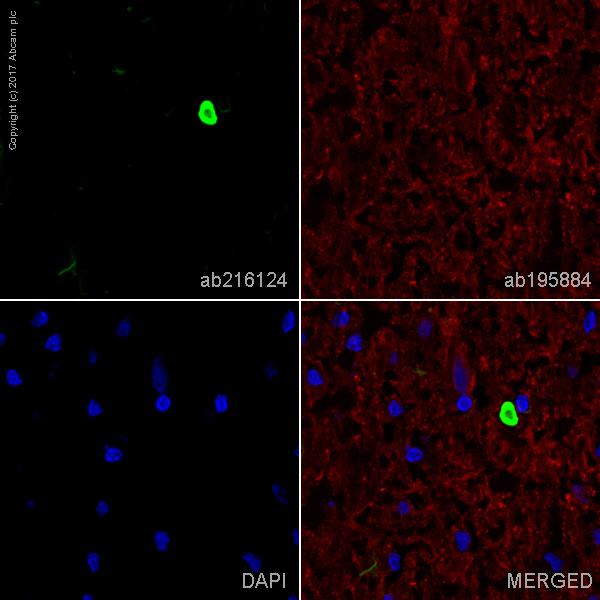 Immunohistochemistry (Frozen sections) - Alexa Fluor® 488 Anti-Alpha-synuclein aggregate antibody [MJFR-14-6-4-2] - Conformation-Specific (AB216124), expandable thumbnail
