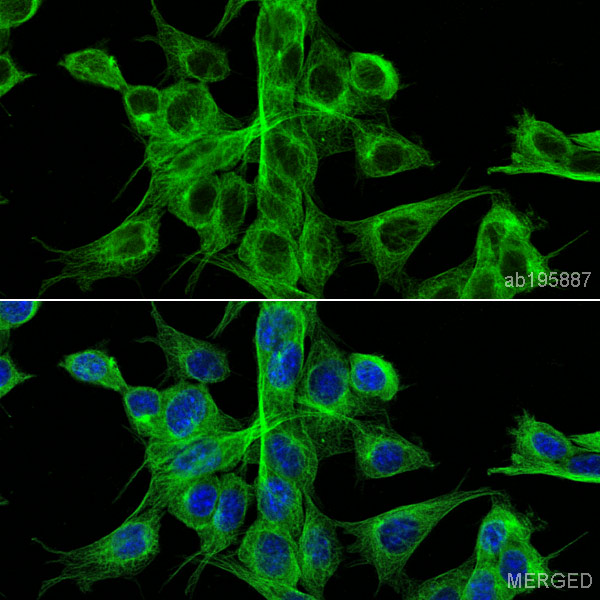 Immunocytochemistry/ Immunofluorescence - Alexa Fluor® 488 Anti-alpha Tubulin antibody [DM1A] - Microtubule Marker (AB195887), expandable thumbnail