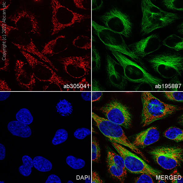Immunocytochemistry/ Immunofluorescence - Alexa Fluor® 488 Anti-alpha Tubulin antibody [DM1A] - Microtubule Marker (AB195887)