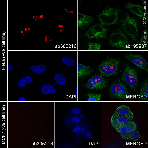 Immunocytochemistry/ Immunofluorescence - Alexa Fluor® 488 Anti-alpha Tubulin antibody [DM1A] - Microtubule Marker (AB195887)