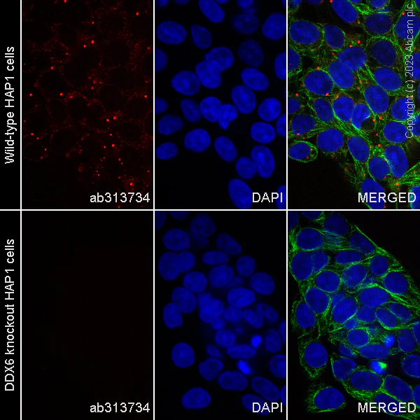 Immunocytochemistry/ Immunofluorescence - Alexa Fluor® 488 Anti-alpha Tubulin antibody [DM1A] - Microtubule Marker (AB195887)