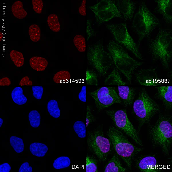 Immunocytochemistry/ Immunofluorescence - Alexa Fluor® 488 Anti-alpha Tubulin antibody [DM1A] - Microtubule Marker (AB195887)