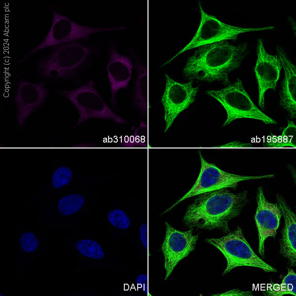Immunocytochemistry/ Immunofluorescence - Alexa Fluor® 488 Anti-alpha Tubulin antibody [DM1A] - Microtubule Marker (AB195887)