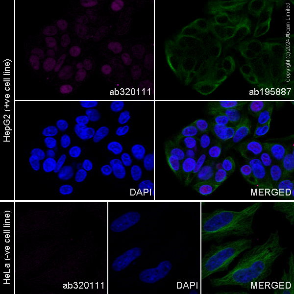 Immunocytochemistry/ Immunofluorescence - Alexa Fluor® 488 Anti-alpha Tubulin antibody [DM1A] - Microtubule Marker (ab195887), expandable thumbnail