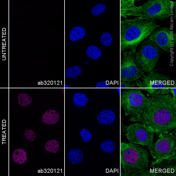 Immunocytochemistry/ Immunofluorescence - Alexa Fluor® 488 Anti-alpha Tubulin antibody [DM1A] - Microtubule Marker (ab195887), expandable thumbnail