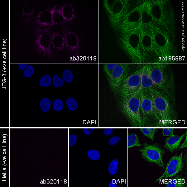 Immunocytochemistry/ Immunofluorescence - Alexa Fluor® 488 Anti-alpha Tubulin antibody [DM1A] - Microtubule Marker (ab195887), expandable thumbnail