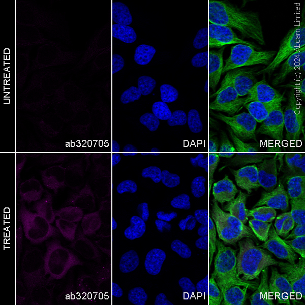 Immunocytochemistry/ Immunofluorescence - Alexa Fluor® 488 Anti-alpha Tubulin antibody [DM1A] - Microtubule Marker (ab195887), expandable thumbnail