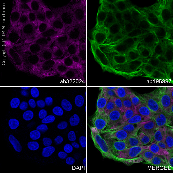 Immunocytochemistry/ Immunofluorescence - Alexa Fluor® 488 Anti-alpha Tubulin antibody [DM1A] - Microtubule Marker (ab195887), expandable thumbnail