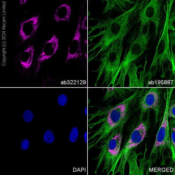 Immunocytochemistry/ Immunofluorescence - Alexa Fluor® 488 Anti-alpha Tubulin antibody [DM1A] - Microtubule Marker (ab195887), expandable thumbnail